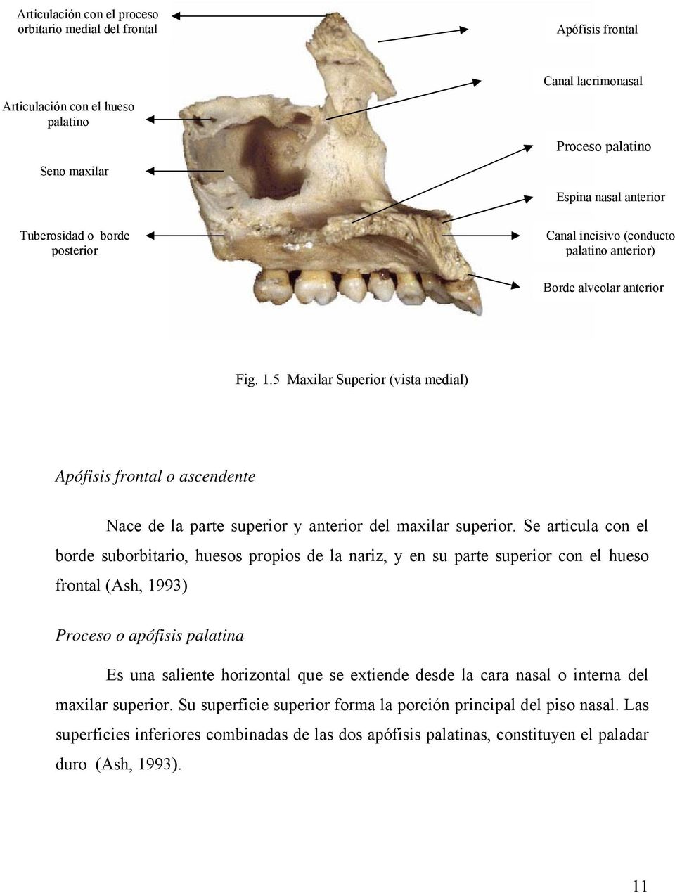 5 Maxilar Superior (vista medial) Apófisis frontal o ascendente Nace de la parte superior y anterior del maxilar superior.