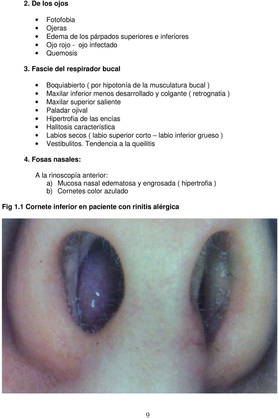 superior saliente Paladar ojival Hipertrofia de las encías Halitosis característica Labios secos ( labio superior corto labio inferior grueso ) Vestibulitos.