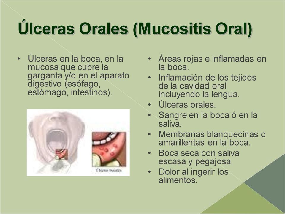 Inflamación de los tejidos de la cavidad oral incluyendo la lengua. Úlceras orales.