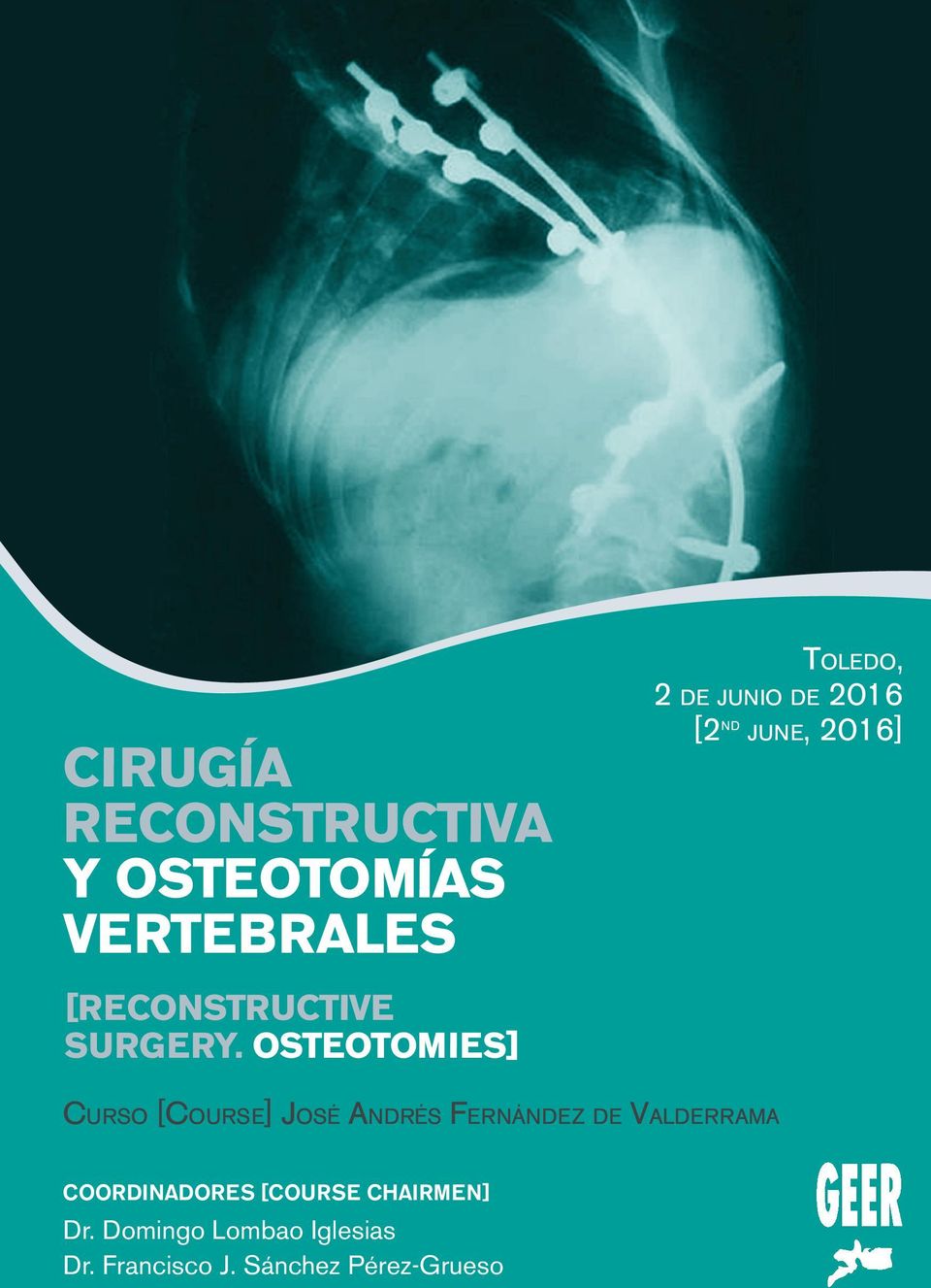 osteotomies] CURSO [COURSE] JOSÉ ANDRÉS FERNÁNDEZ DE VALDERRAMA