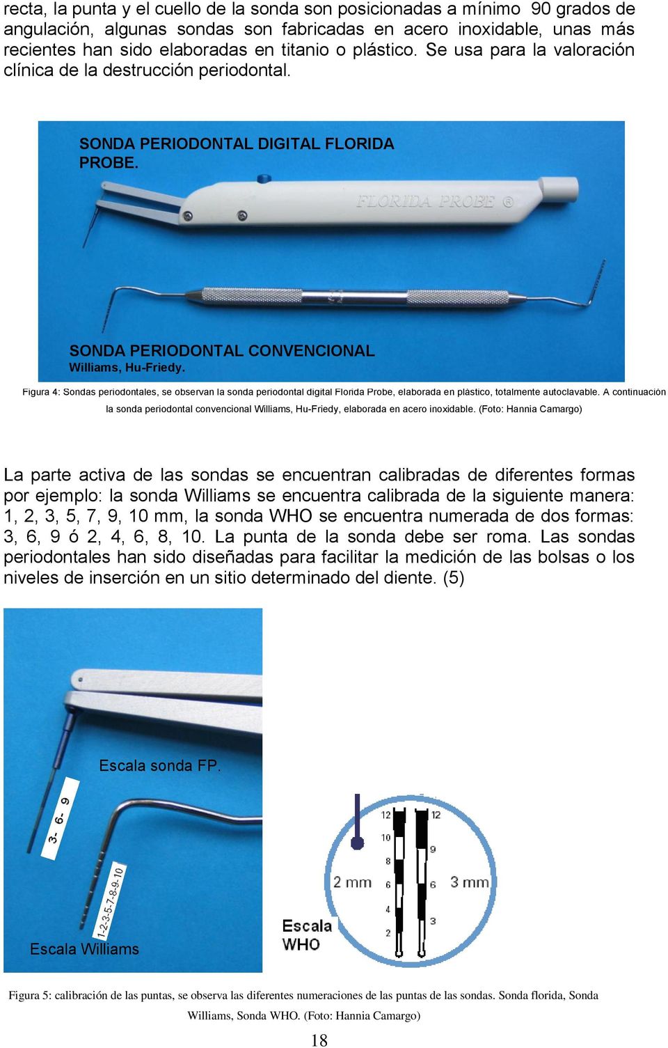Figura 4: Sondas periodontales, se observan la sonda periodontal digital Florida Probe, elaborada en plástico, totalmente autoclavable.