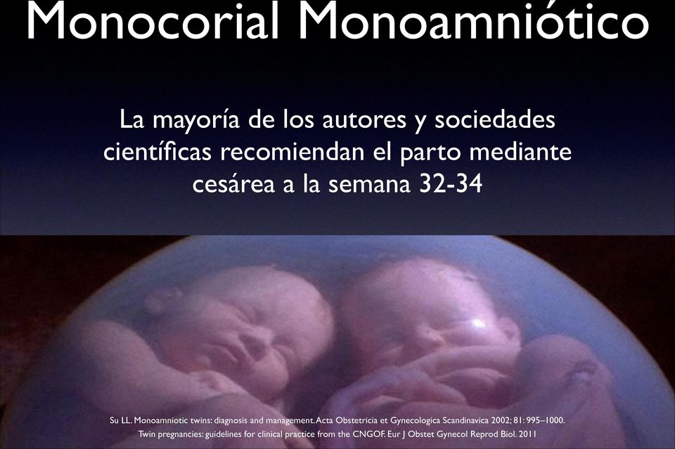 Monoamniotic twins: diagnosis and management.