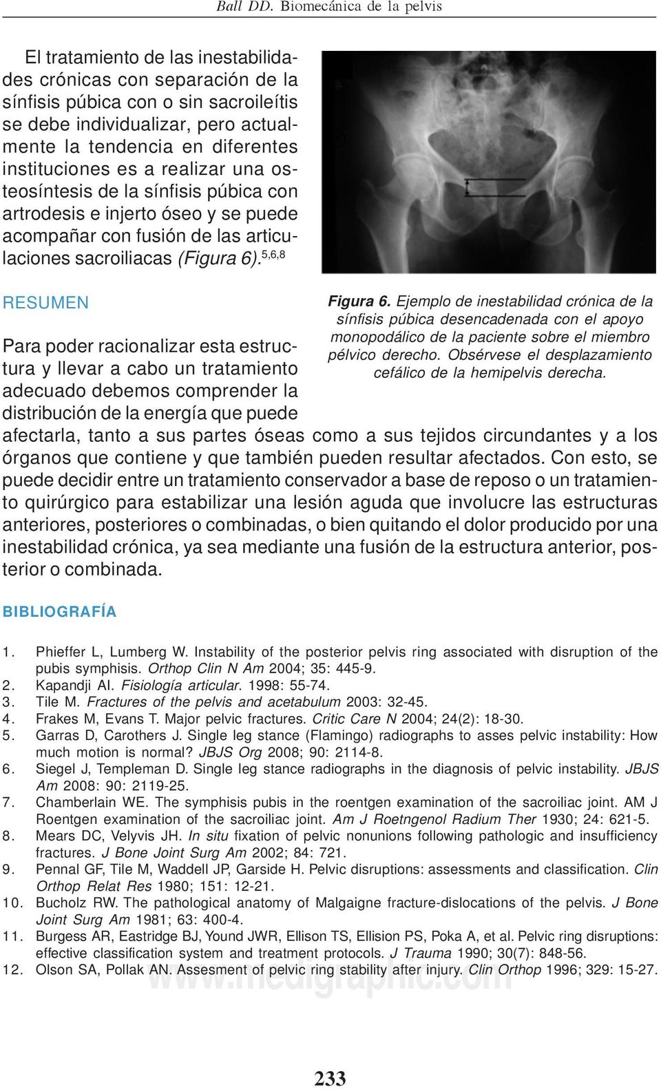 instituciones es a realizar una osteosíntesis de la sínfisis púbica con artrodesis e injerto óseo y se puede acompañar con fusión de las articulaciones sacroiliacas (Figura 6).