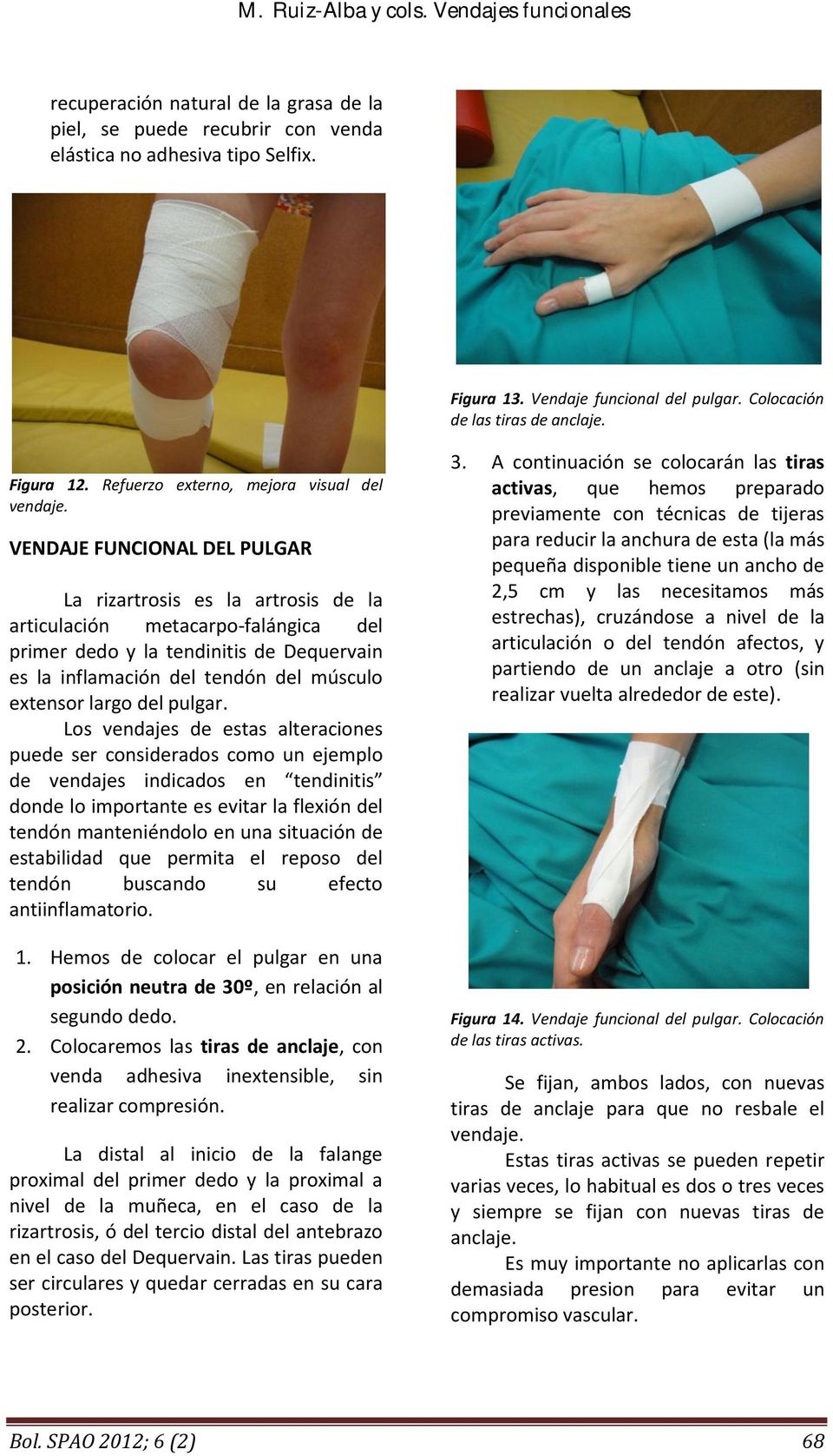 VENDAJE FUNCIONAL DEL PULGAR La rizartrosis es la artrosis de la articulación metacarpo-falángica del primer dedo y la tendinitis de Dequervain es la inflamación del tendón del músculo extensor largo