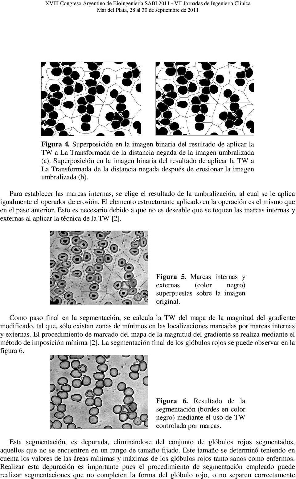 Superposición en la imagen binaria del resultado de aplicar la TW a La Transformada de la distancia negada después de erosionar la imagen umbralizada (b).