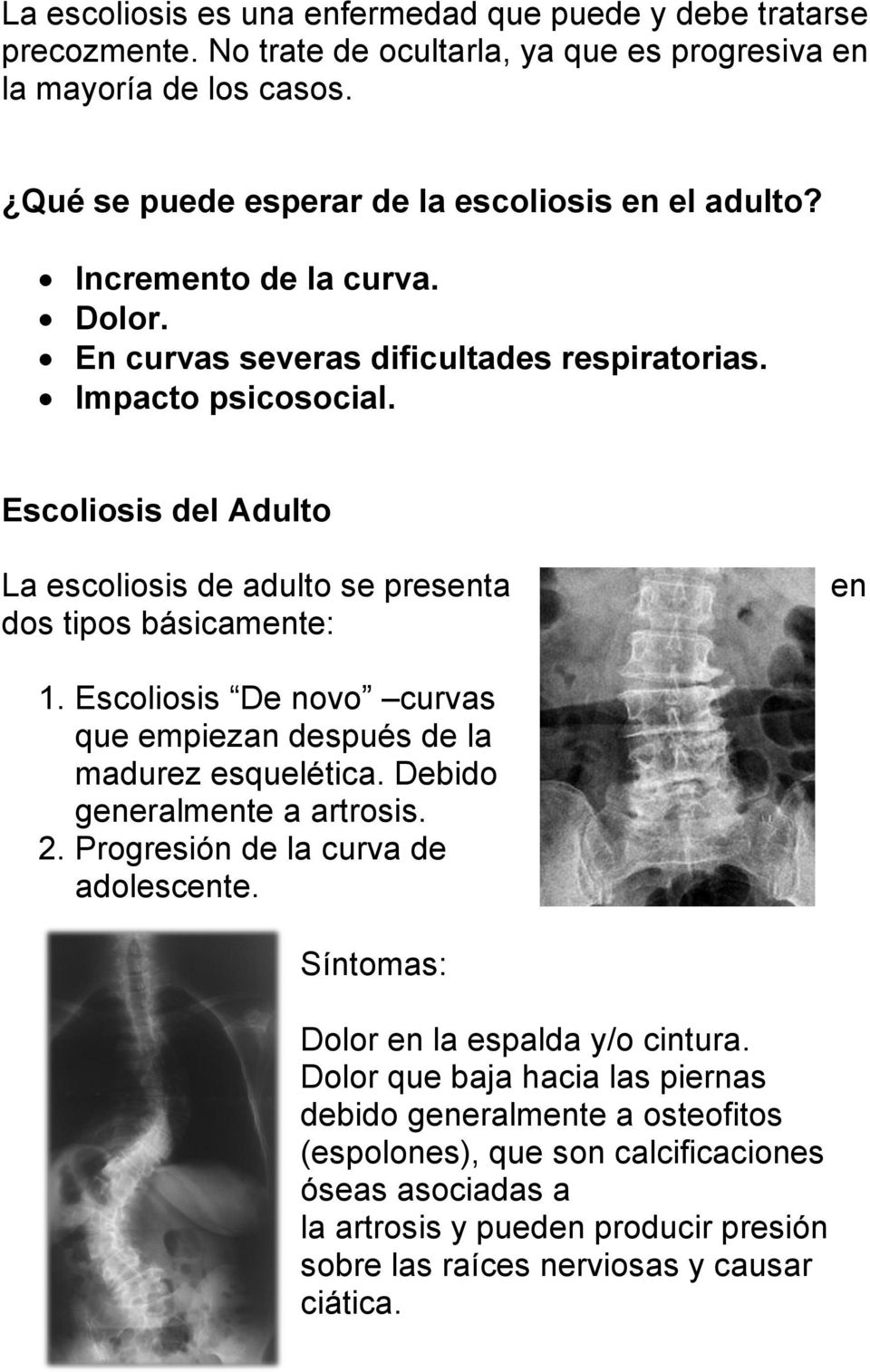 Escoliosis De novo curvas que empiezan después de la madurez esquelética. Debido generalmente a artrosis. 2. Progresión de la curva de adolescente. Síntomas: Dolor en la espalda y/o cintura.