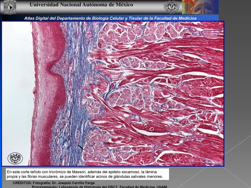 propia y las fibras musculares, se pueden identificar acinos de