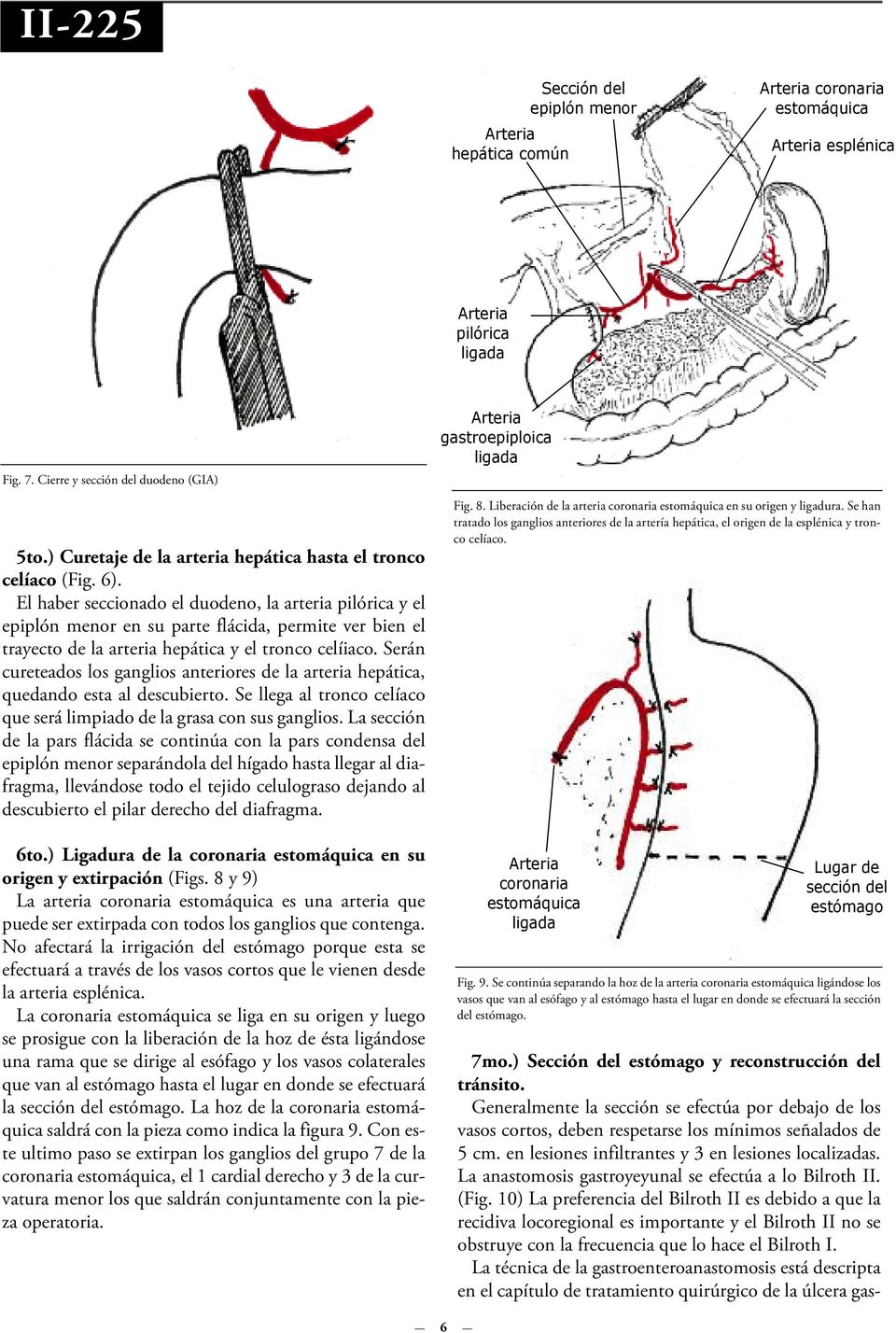 El haber seccionado el duodeno, la arteria pilórica y el epiplón menor en su parte flácida, permite ver bien el trayecto de la arteria hepática y el tronco celíiaco.