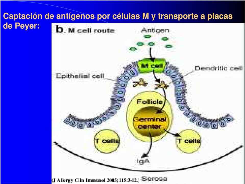 células M y