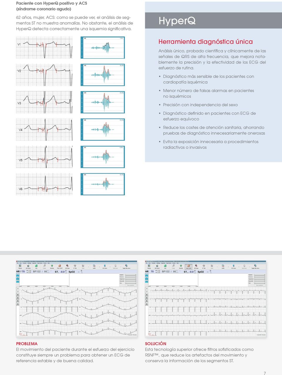 HyperQ Herramienta diagnóstica única nálisis único, probado científica y clínicamente de las señales de QRS de alta frecuencia, que mejora notablemente la precisión y la efectividad de los ECG del
