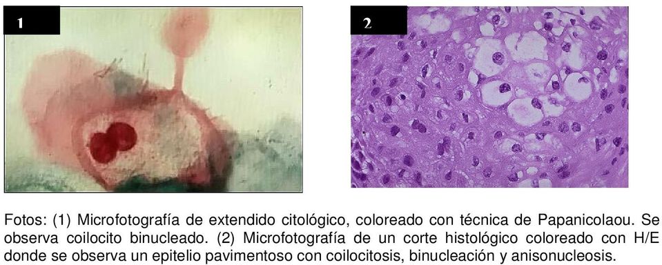 (2) Microfotografía de un corte histológico coloreado con H/E donde
