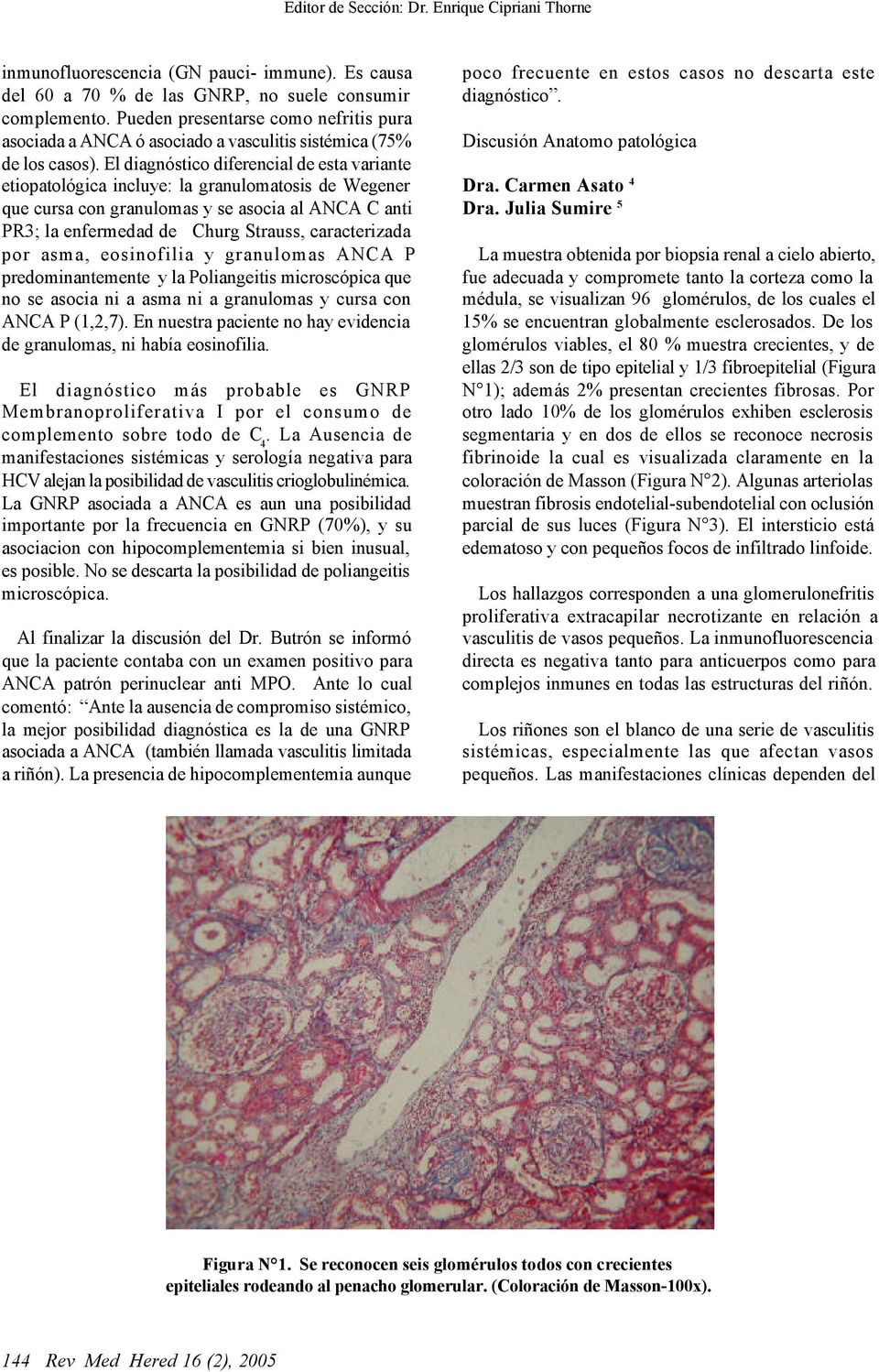 El diagnóstico diferencial de esta variante etiopatológica incluye: la granulomatosis de Wegener que cursa con granulomas y se asocia al ANCA C anti PR3; la enfermedad de Churg Strauss, caracterizada