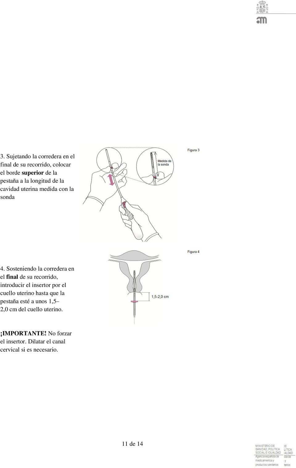 Sosteniendo la corredera en el final de su recorrido, introducir el insertor por el cuello uterino