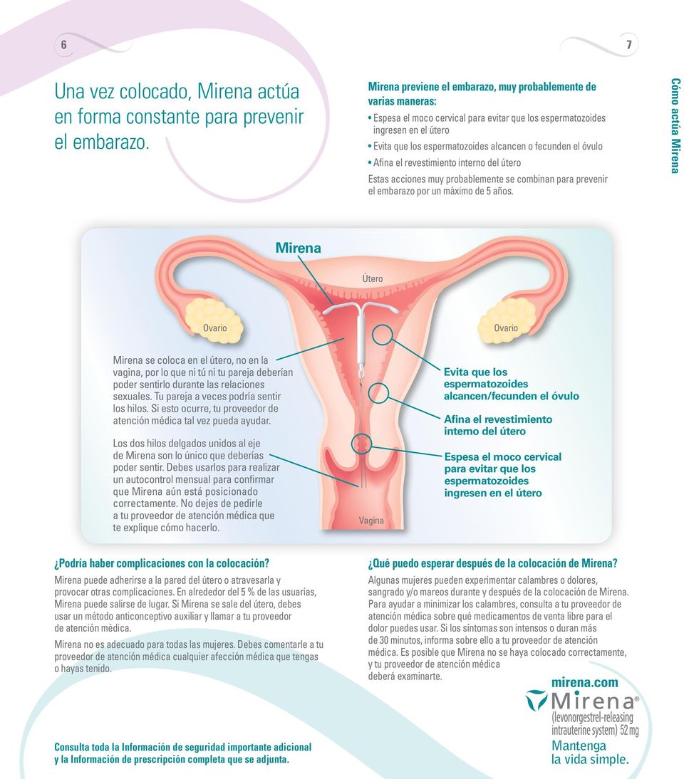 óvulo Afina el revestimiento interno del útero Estas acciones muy probablemente se combinan para prevenir el embarazo por un máximo de 5 años.