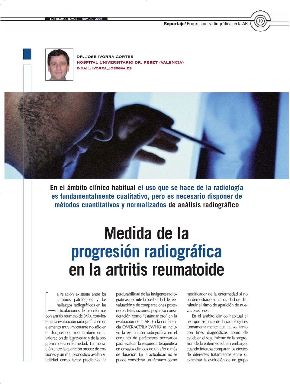 Medida de la progresión radiográfica en la artritis reumatoide La relación existente entre los cambios patológicos y los hallazgos radiográficos en las articulaciones de los enfermos con artritis