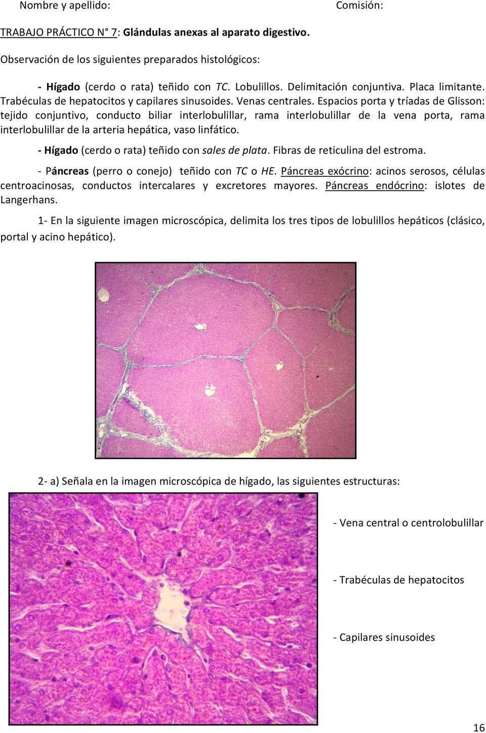 Espacios porta y tríadas de Glisson: tejido conjuntivo, conducto biliar interlobulillar, rama interlobulillar de la vena porta, rama interlobulillar de la arteria hepática, vaso linfático.