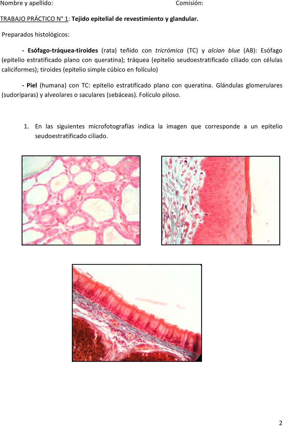 tráquea (epitelio seudoestratificado ciliado con células caliciformes); tiroides (epitelio simple cúbico en folículo) Piel (humana) con TC: epitelio