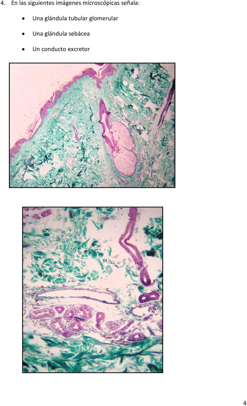 glándula tubular glomerular Una