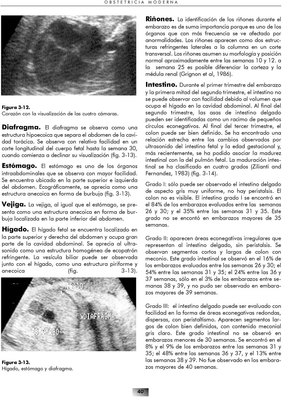 a la semana 25 es posible diferenciar la corteza y la médula renal (Grignon et al, 1986). Figura 3-12. Corazón con la visualización de las cuatro cámaras. Diafragma.