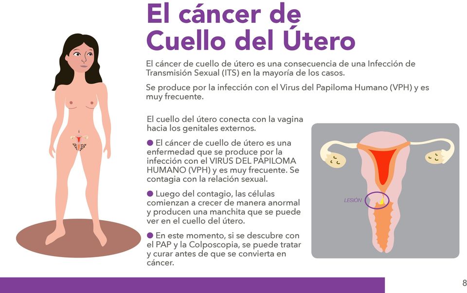 l El cáncer de cuello de útero es una enfermedad que se produce por la infección con el VIRUS DEL PAPILOMA HUMANO (VPH) y es muy frecuente. Se contagia con la relación sexual.