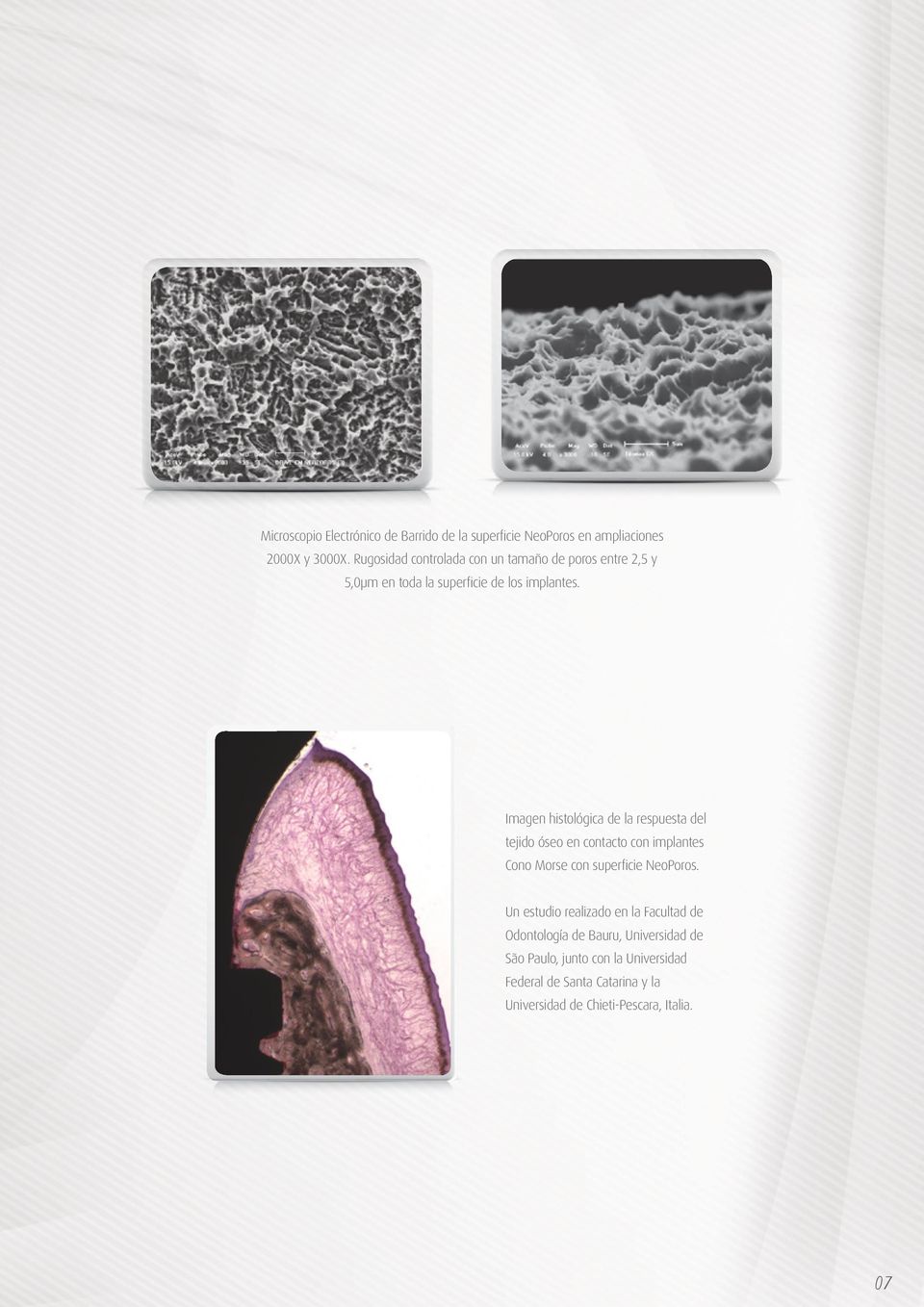 Imagen histológica de la respuesta del tejido óseo en contacto con implantes Cono Morse con superficie NeoPoros.
