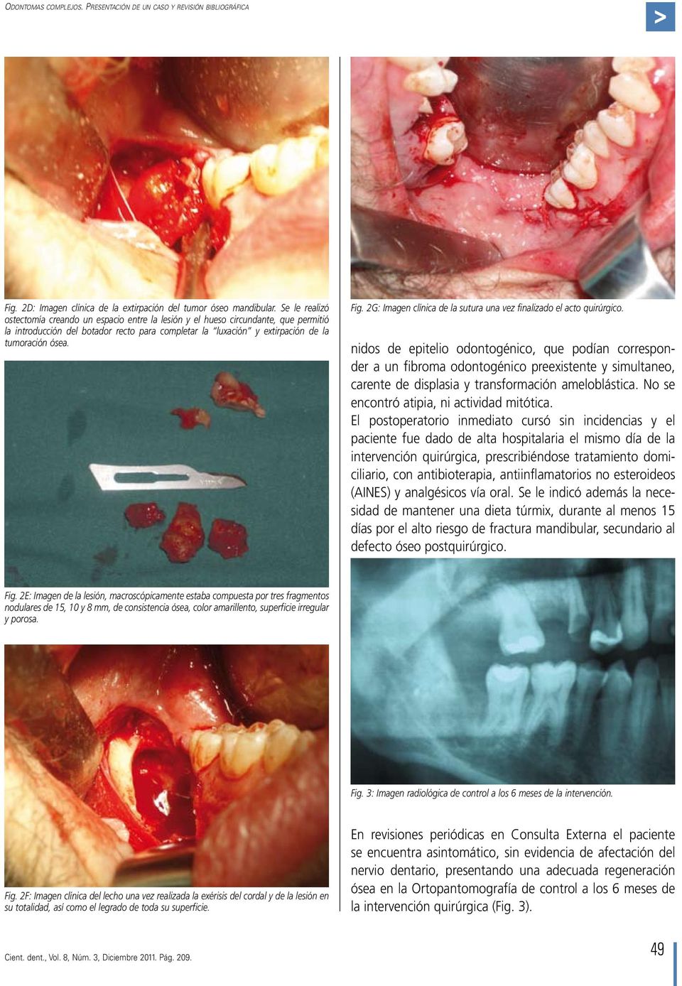 2G: Imagen clínica de la sutura una vez finalizado el acto quirúrgico.