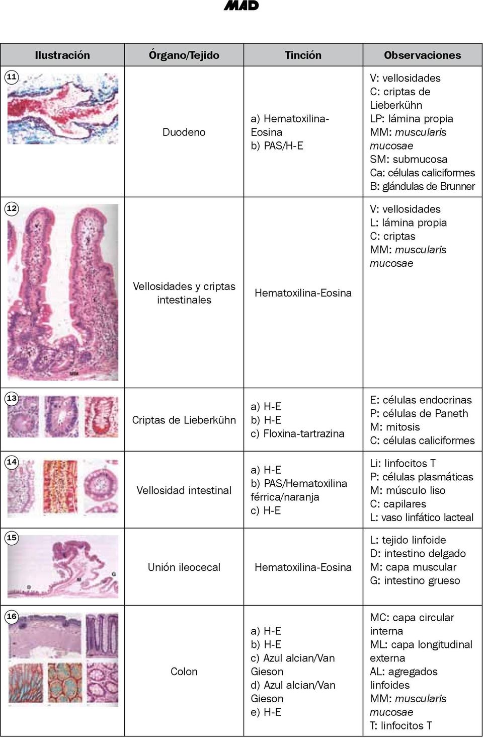 Paneth M: mitosis C: células caliciformes 14 Vellosidad intestinal a) H-E b) PAS/Hematoxilina férrica/naranja c) H-E Li: linfocitos T P: células plasmáticas M: músculo liso C: capilares L: vaso