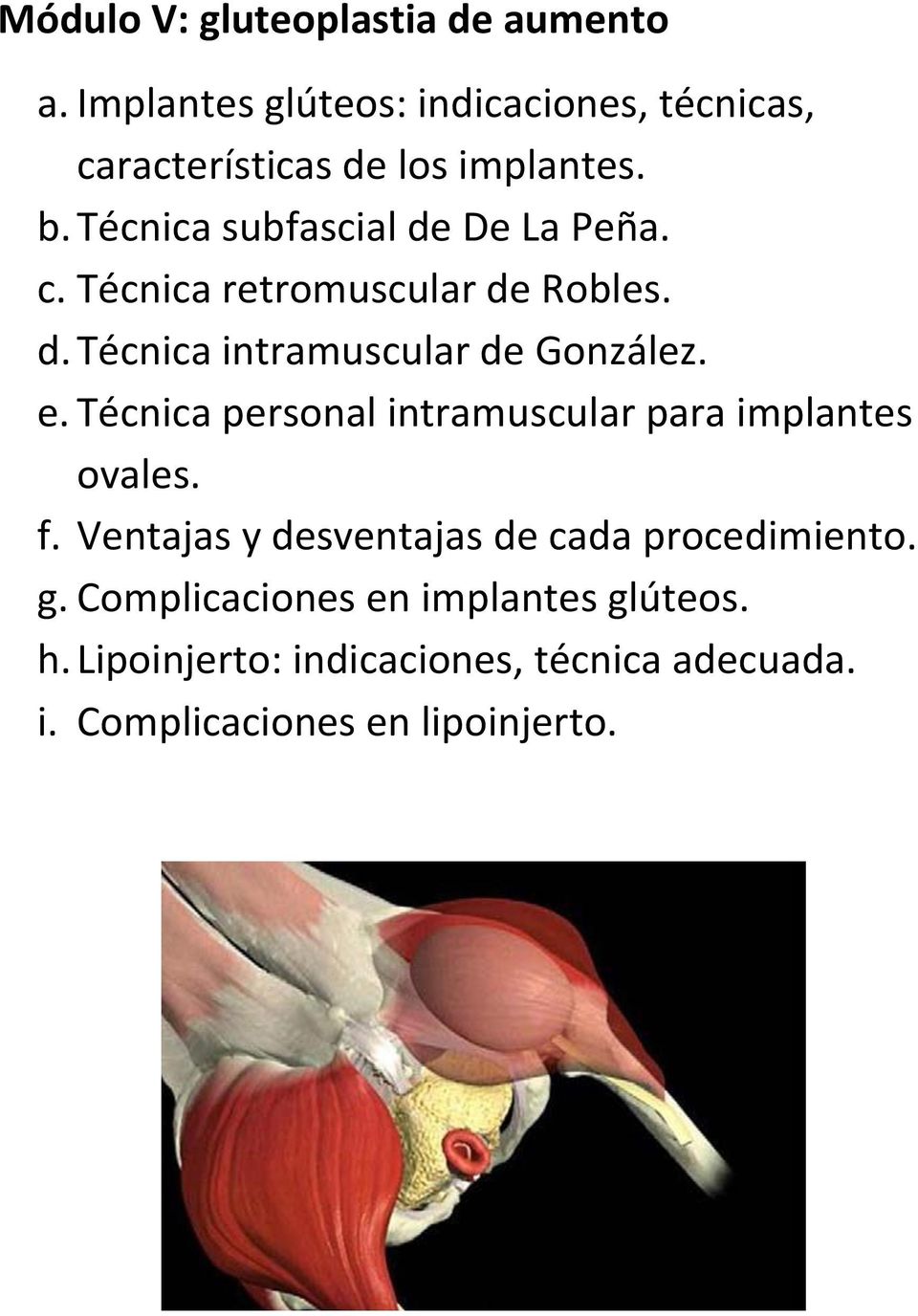 Técnica personal intramuscular para implantes ovales. f. Ventajas y desventajas de cada procedimiento. g.