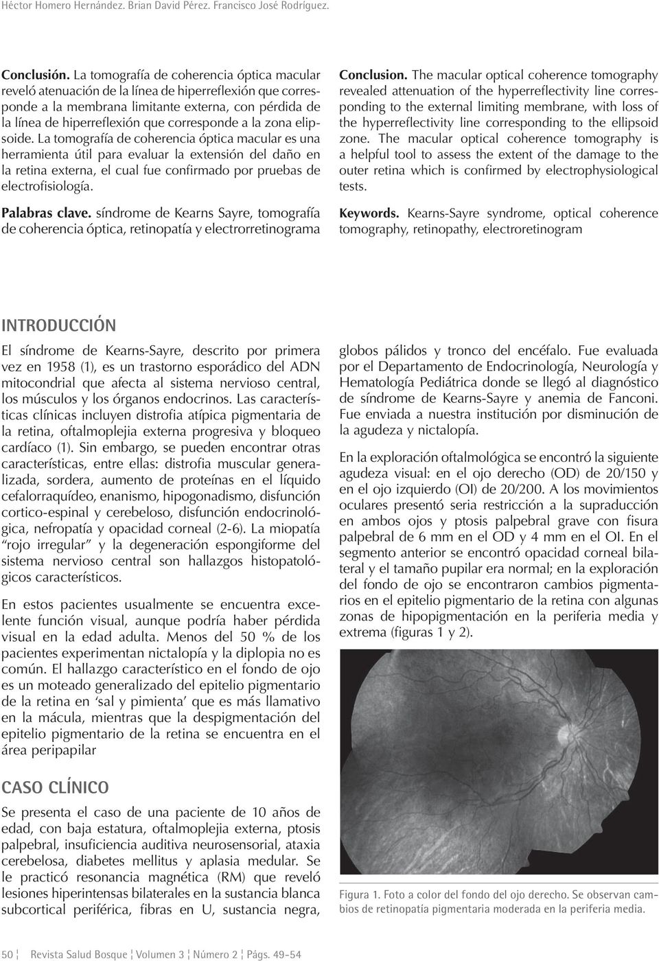 la zona elipsoide. La tomografía de coherencia óptica macular es una herramienta útil para evaluar la extensión del daño en la retina externa, el cual fue confirmado por pruebas de electrofisiología.