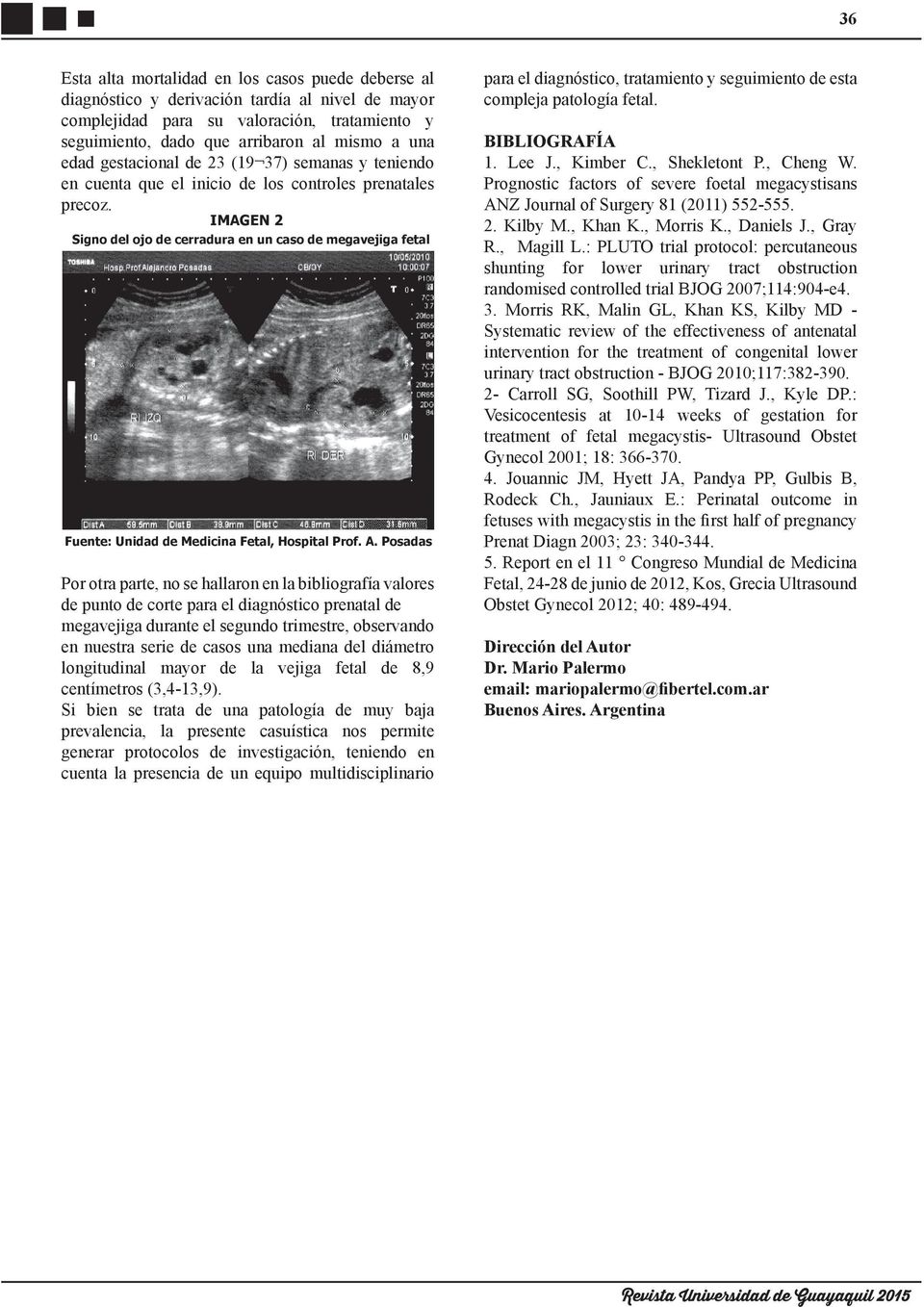 IMAGE gno del ojo de cerradura en un caso de megavejiga fetal Fuente: Unidad de Medicina Fetal, Hospital Prof. A.
