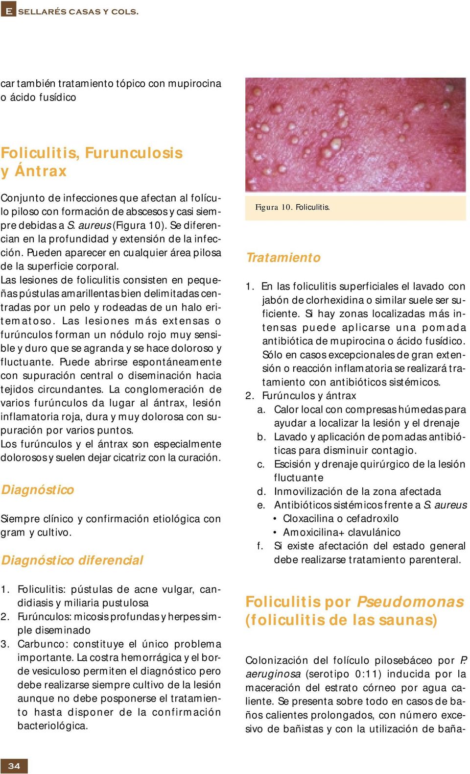 debidas a S. aureus (Figura 10). Se diferencian en la profundidad y extensión de la infección. Pueden aparecer en cualquier área pilosa de la superficie corporal.