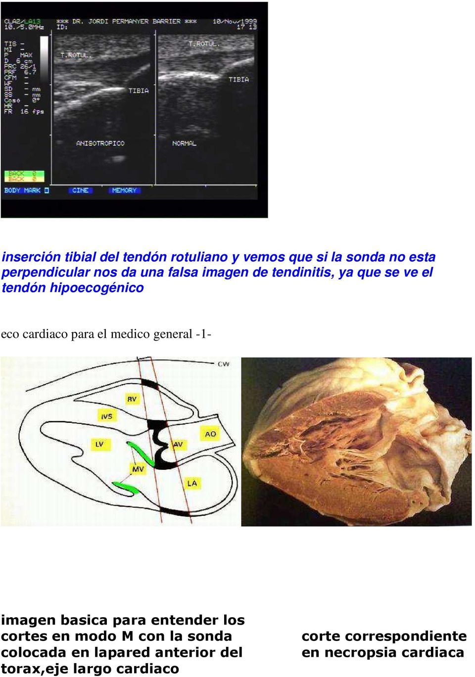 medico general -1- imagen basica para entender los cortes en modo M con la sonda colocada