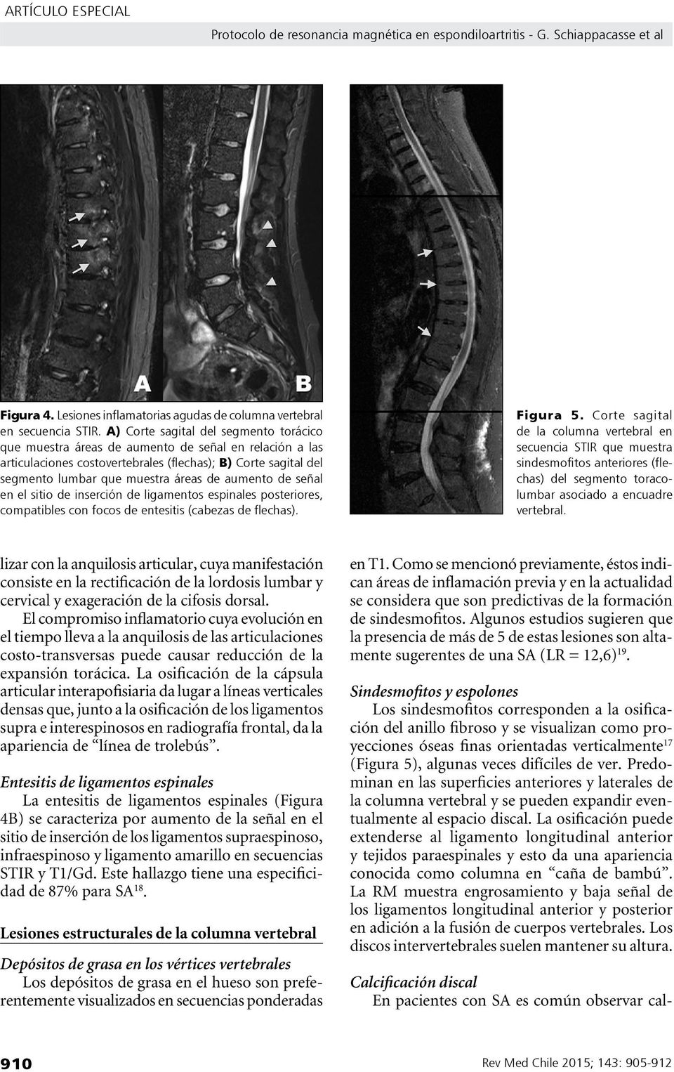 aumento de señal en el sitio de inserción de ligamentos espinales posteriores, compatibles con focos de entesitis (cabezas de flechas). Figura 5.