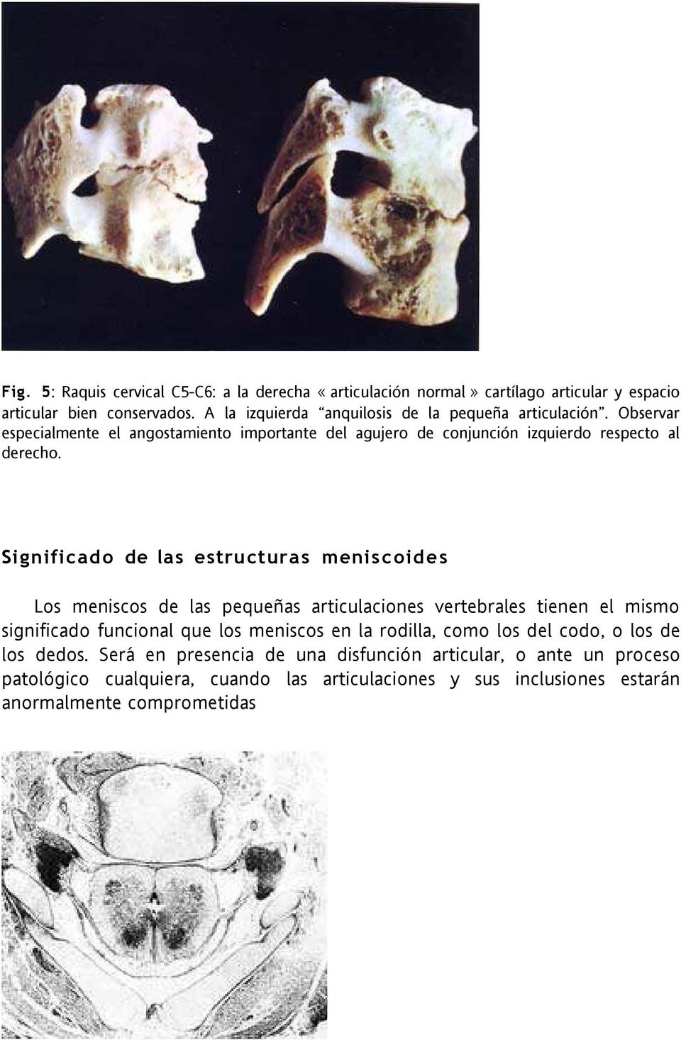 Significado de las estructuras meniscoides Los meniscos de las pequeñas articulaciones vertebrales tienen el mismo significado funcional que los meniscos en la