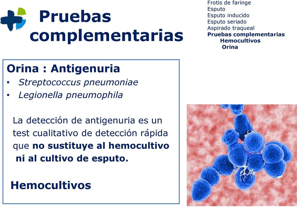 detección de antigenuria es un test cualitativo de
