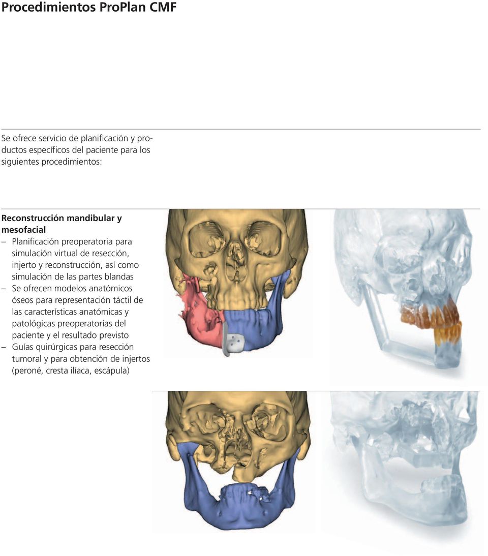 simulación de las partes blandas Se ofrecen modelos anatómicos óseos para representación táctil de las características anatómicas y patológicas
