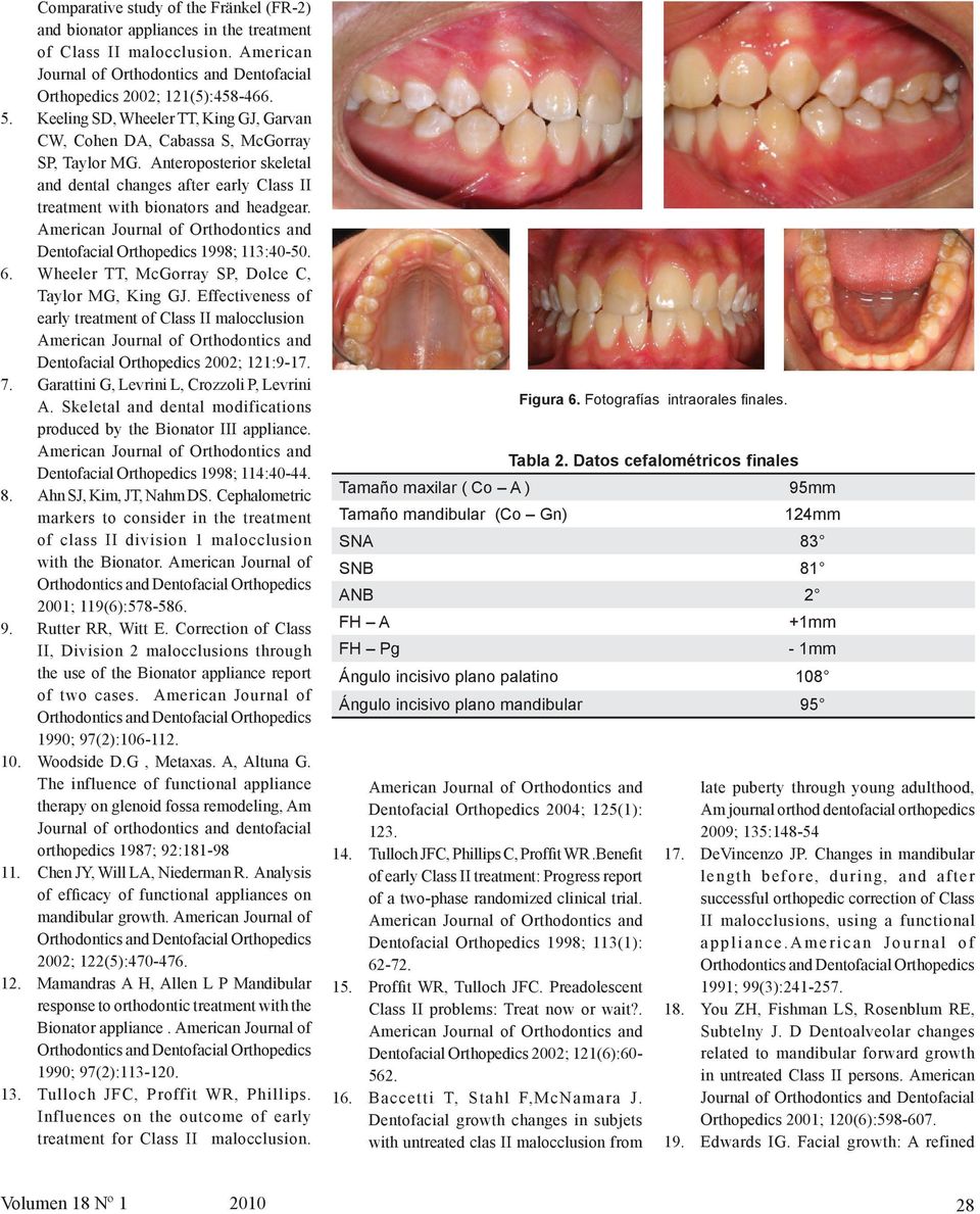 Dentofacial Orthopedics 1998; 113:40-50. 6. Wheeler TT, McGorray SP, Dolce C, Taylor MG, King GJ. Effectiveness of early treatment of Class II malocclusion Dentofacial Orthopedics 2002; 121:9-17. 7.