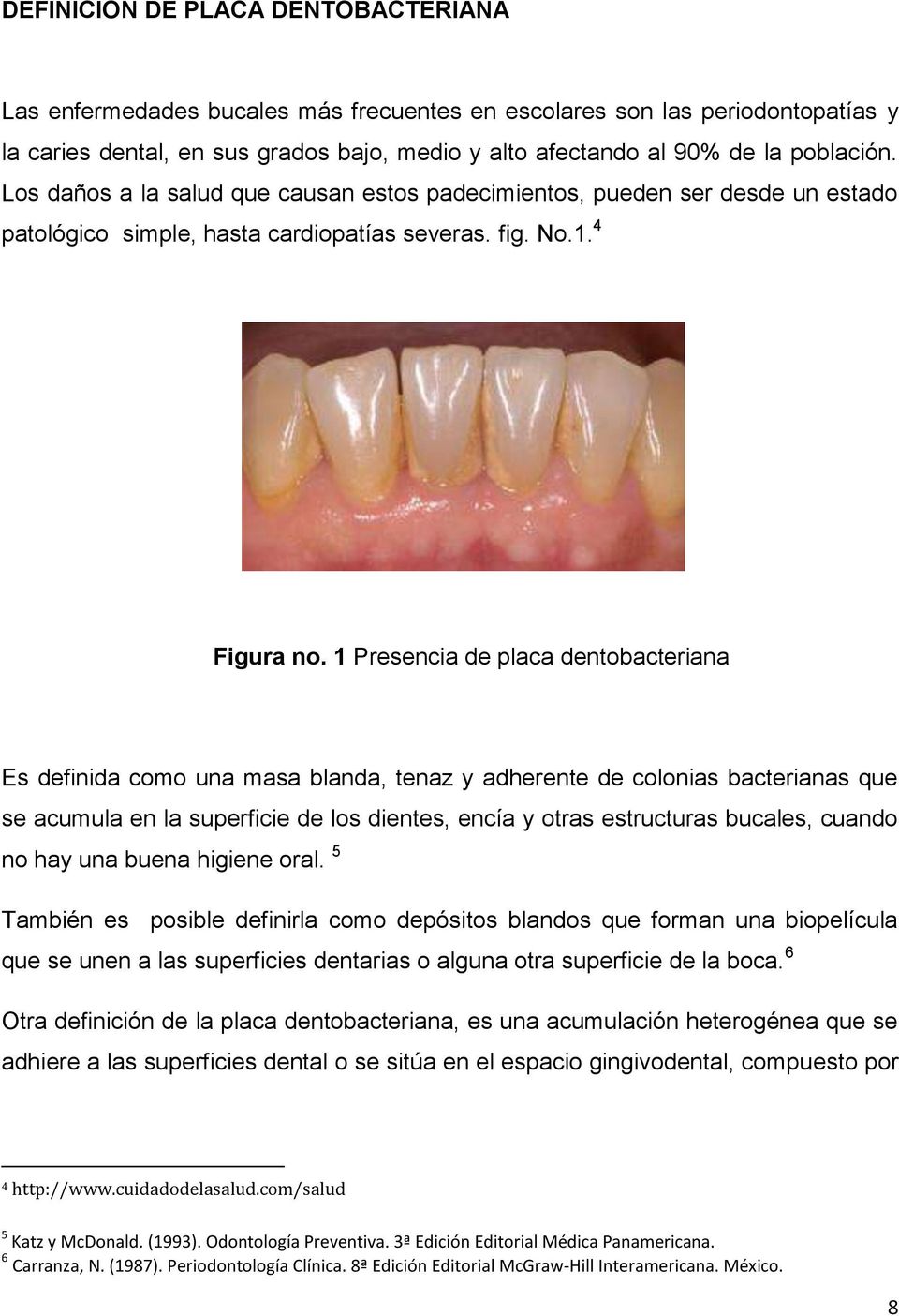 1 Presencia de placa dentobacteriana Es definida como una masa blanda, tenaz y adherente de colonias bacterianas que se acumula en la superficie de los dientes, encía y otras estructuras bucales,