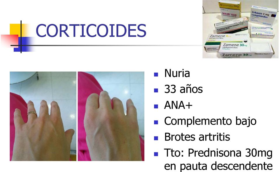 Brotes artritis Tto: