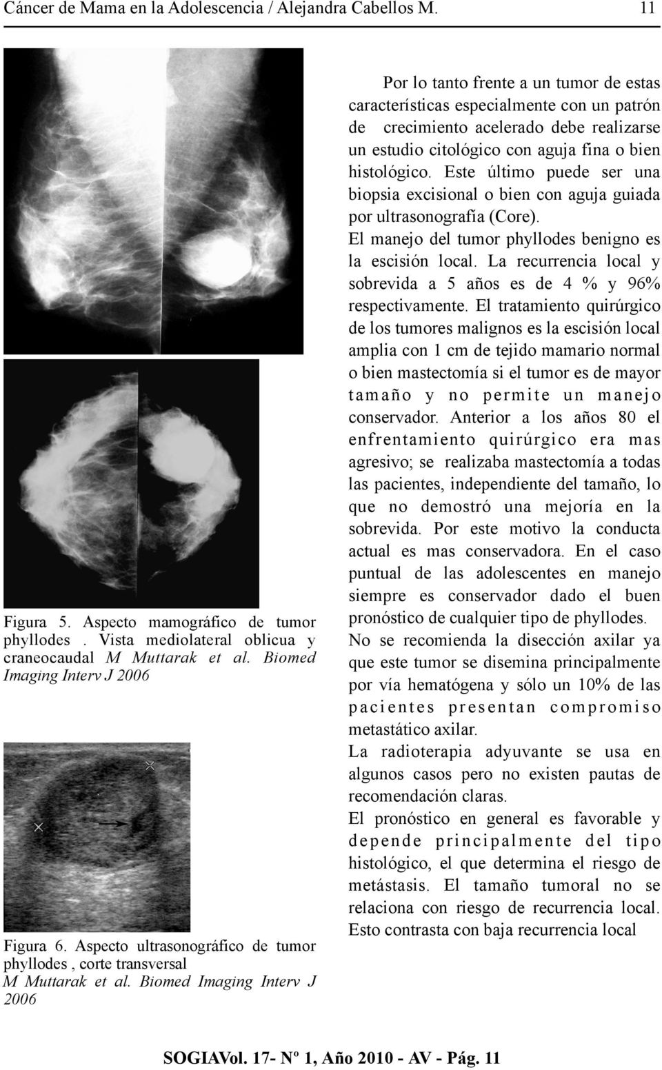 Biomed Imaging Interv J 2006 11 Por lo tanto frente a un tumor de estas características especialmente con un patrón de crecimiento acelerado debe realizarse un estudio citológico con aguja fina o