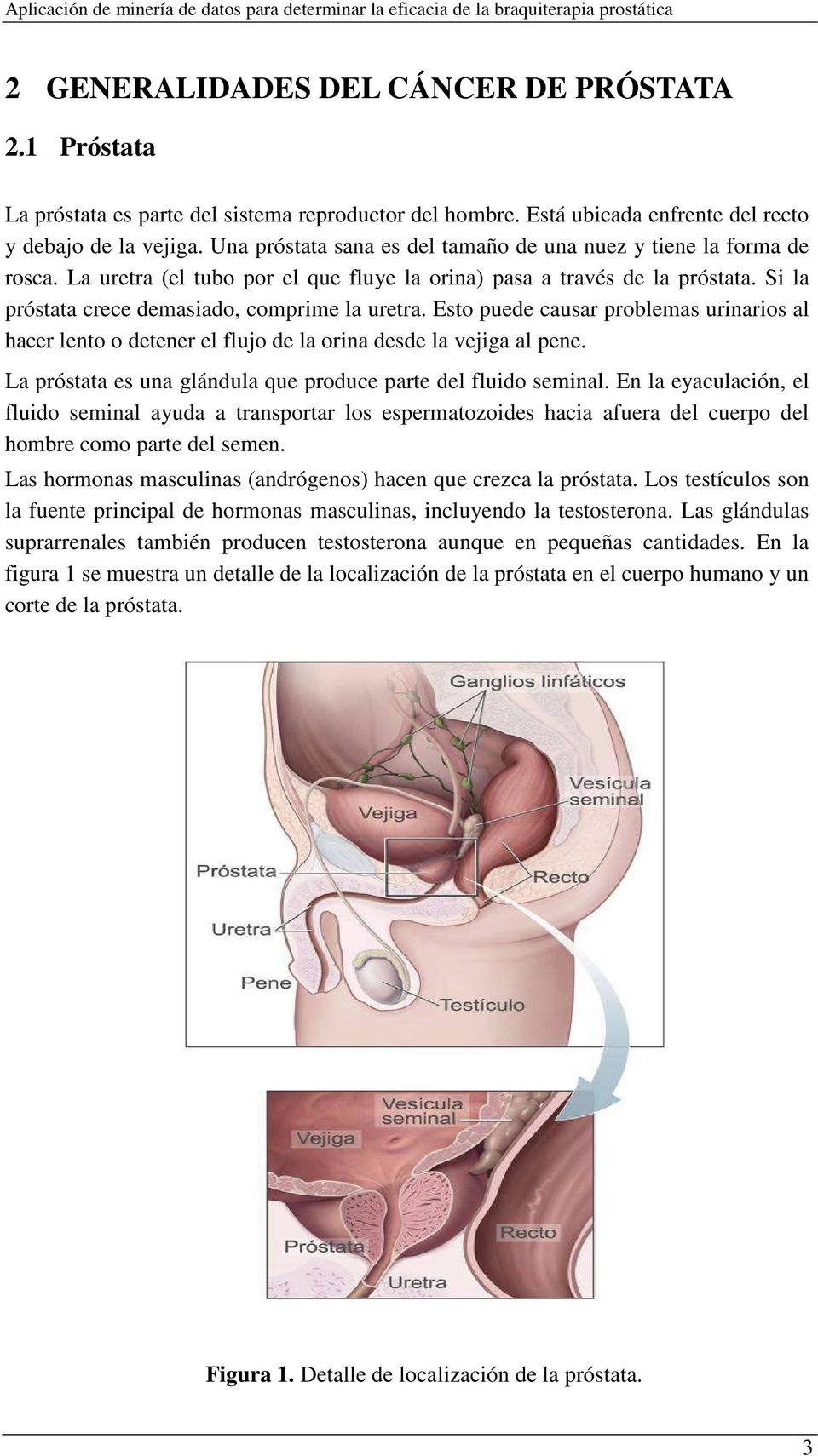Esto puede causar problemas urinarios al hacer lento o detener el flujo de la orina desde la vejiga al pene. La próstata es una glándula que produce parte del fluido seminal.