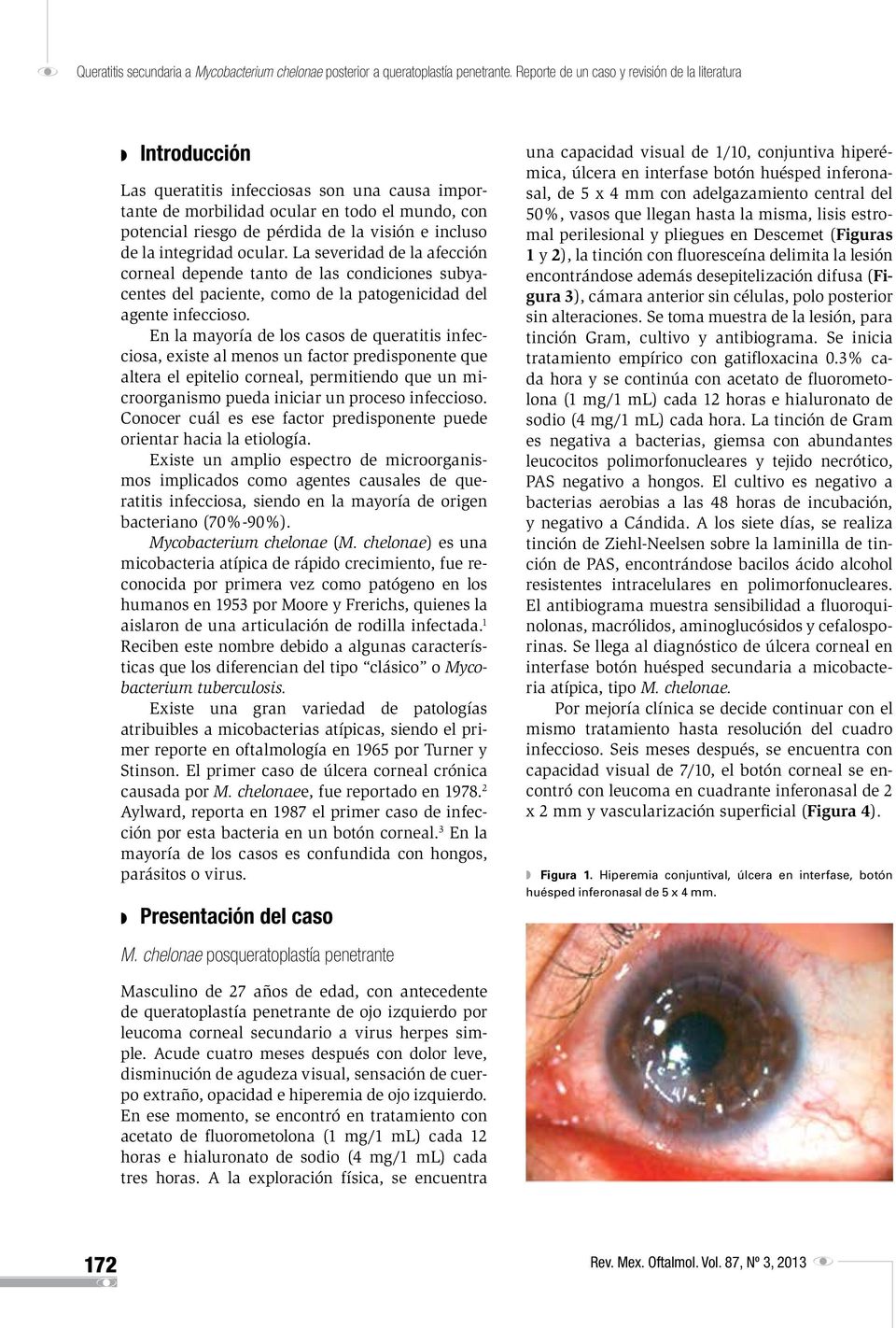 incluso de la integridad ocular. La severidad de la afección corneal depende tanto de las condiciones subyacentes del paciente, como de la patogenicidad del agente infeccioso.