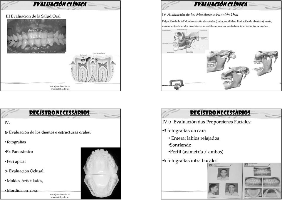 a- Evaluación de los dientes e estructuras orales: fotografías Rx Panorámico Peri apical Registro Necessários IV.