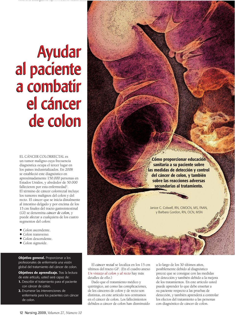 El término de cáncer colorrectal incluye los tumores malignos del colon y del recto.