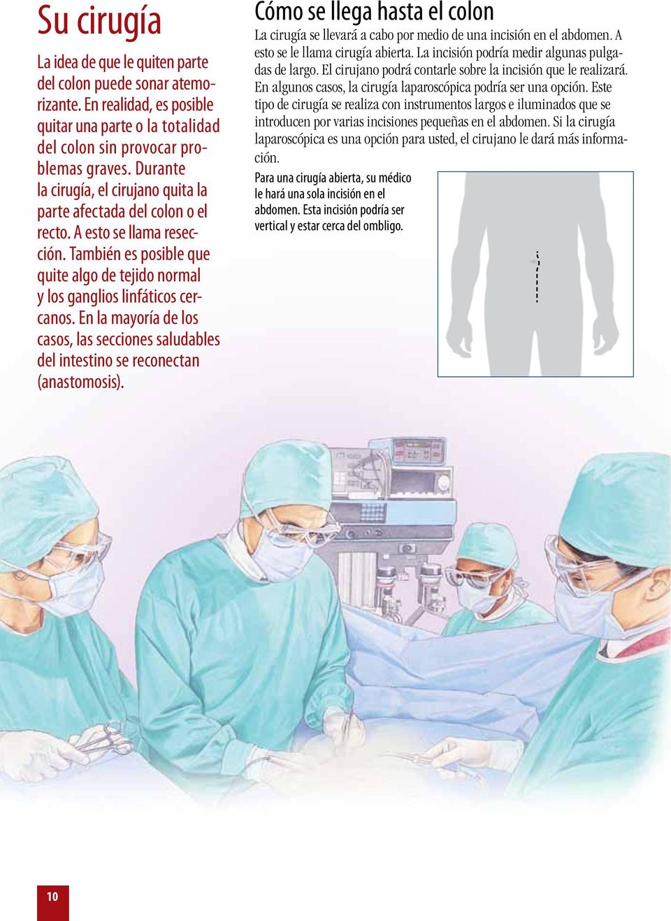 En la mayoría de los casos, las secciones saludables del intestino se reconectan (anastomosis). Cómo se llega hasta el colon La cirugía se llevará a cabo por medio de una incisión en el abdomen.