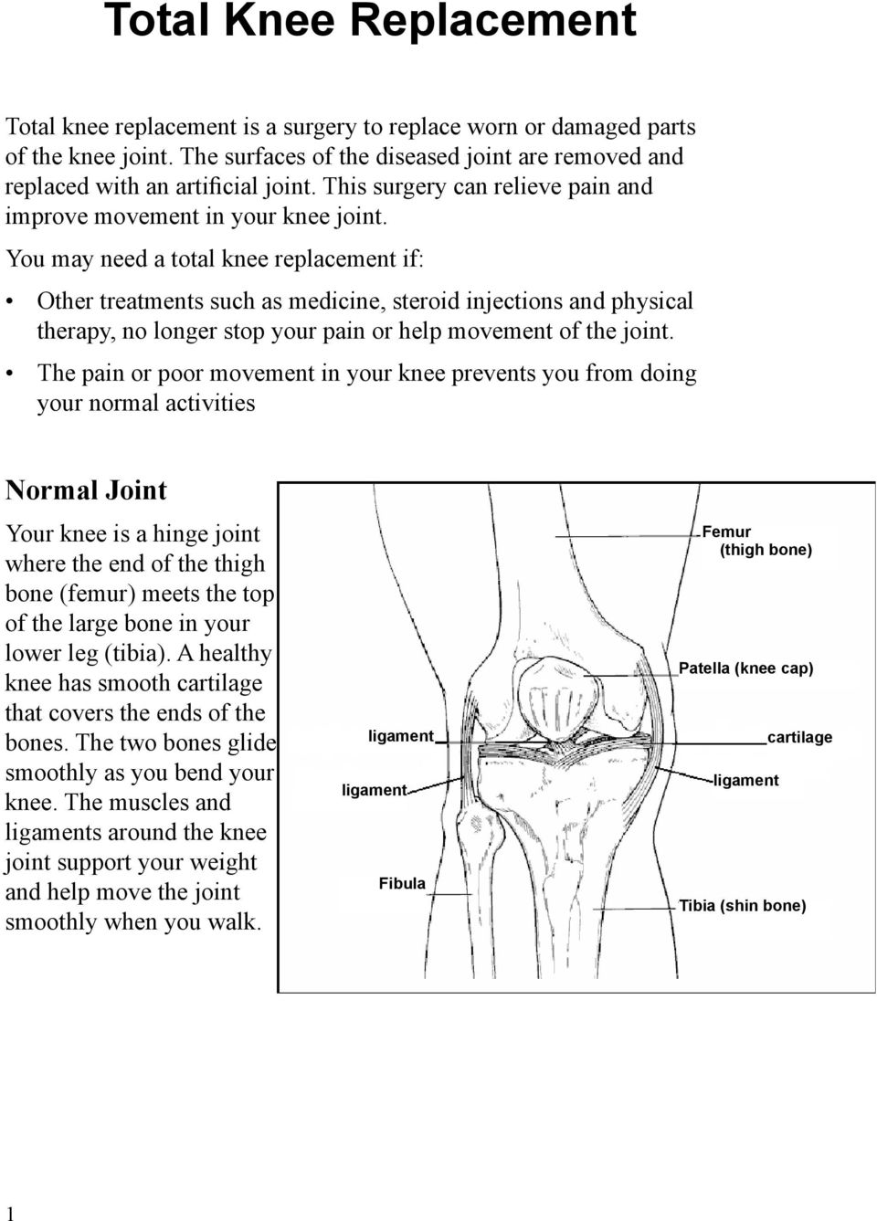 You may need a total knee replacement if: Other treatments such as medicine, steroid injections and physical therapy, no longer stop your pain or help movement of the joint.