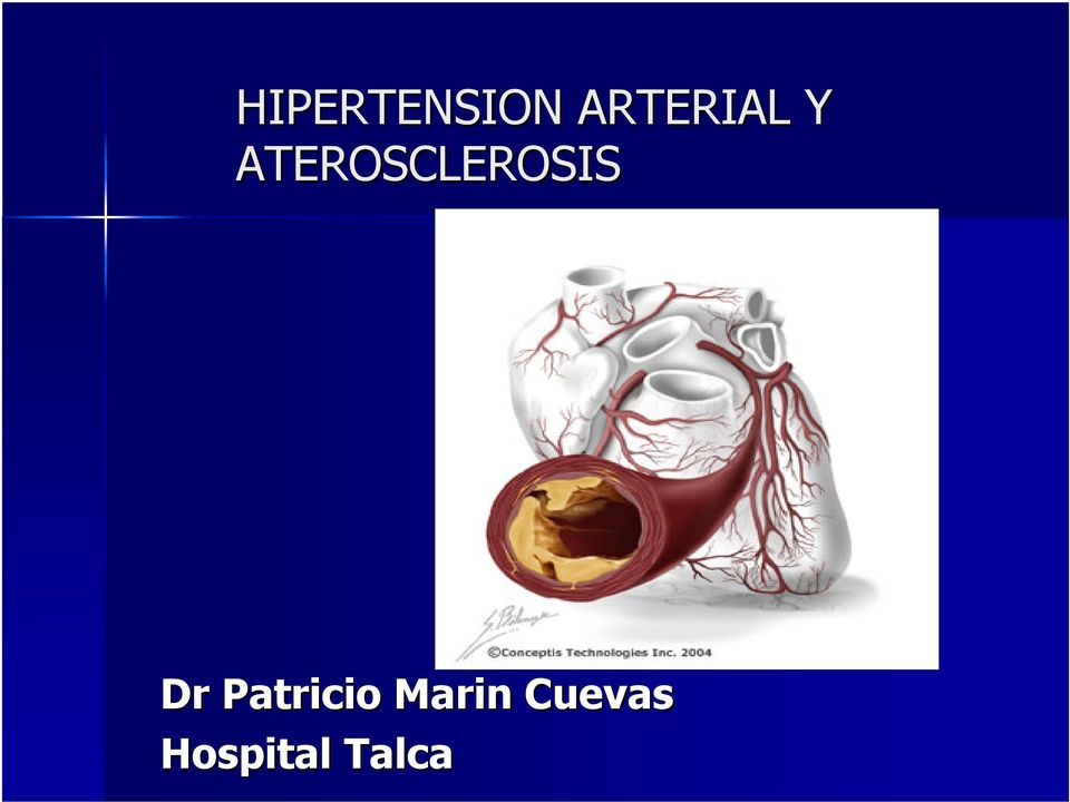 ATEROSCLEROSIS Dr