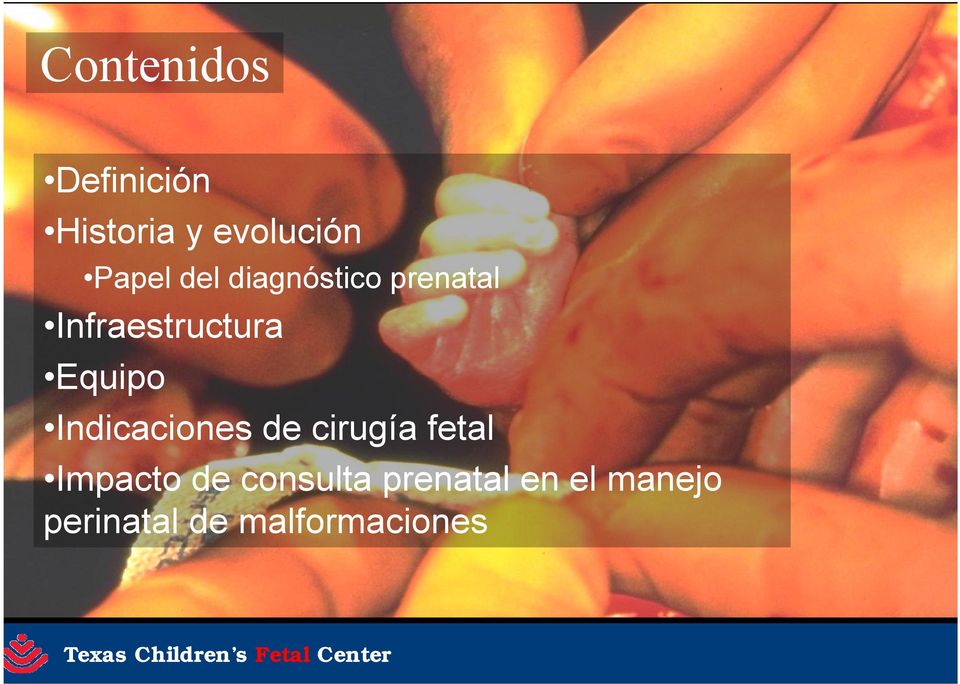 Indicaciones de cirugía fetal Impacto de