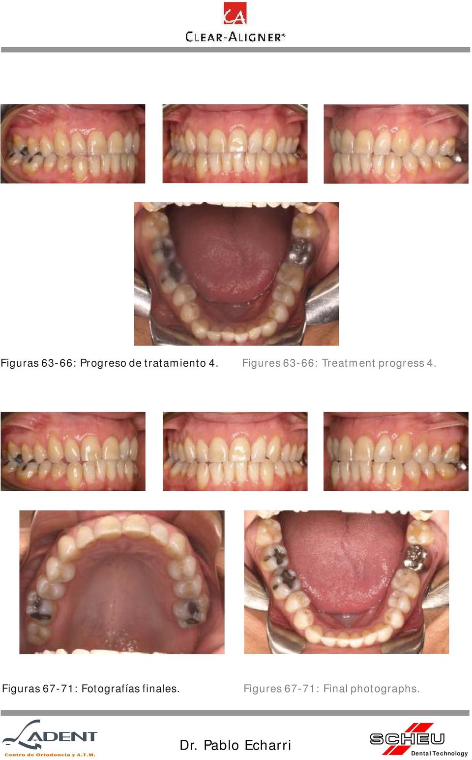 Figures 63-66: Treatment progress 4.