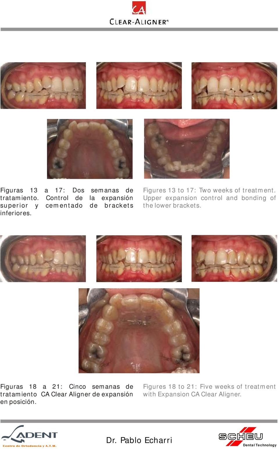 Figures 13 to 17: Two weeks of treatment.